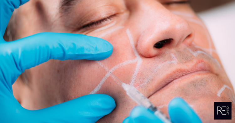 Dermal Filler Safety at REclinic