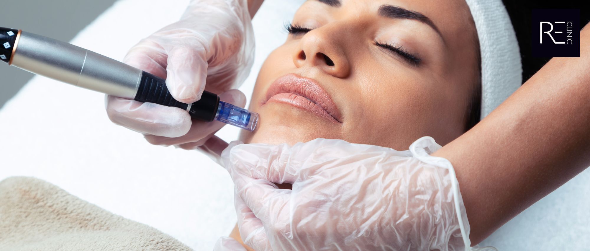 Microneedling improves skin - skincare